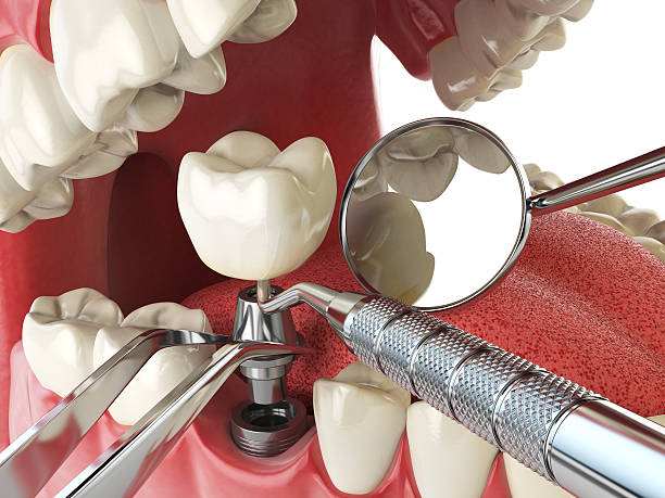 Best Mobile Emergency Dentist in Cairo, GA